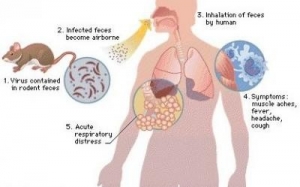 Hantavirus : les sympt&ocirc;mes apr&egrave;s exposition